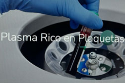 PLASMA rico en plaquetas (L-PRF)